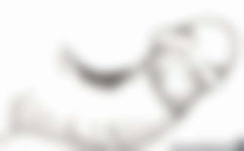 骨粉隆鼻后还能修复吗