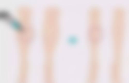 王明青医生口碑评价