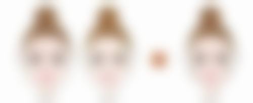 注射隆鼻成效怎么样