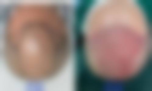 安徽丽儿兰郡花园高第植发擅长项目