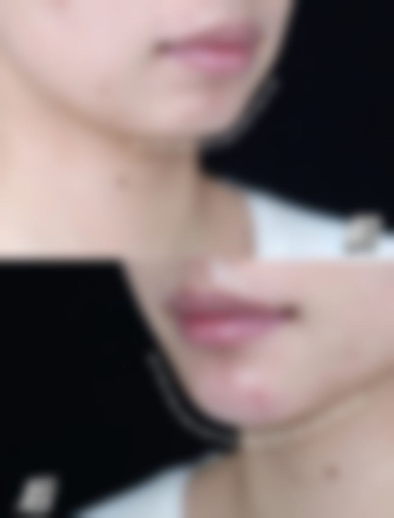 深圳恒美奢颜立整形医院营业时间