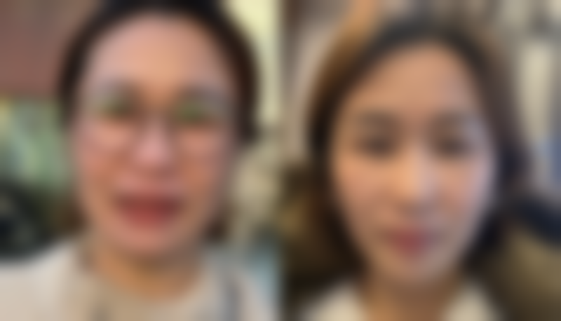 江苏常州美纪医疗美容门诊部真实实例