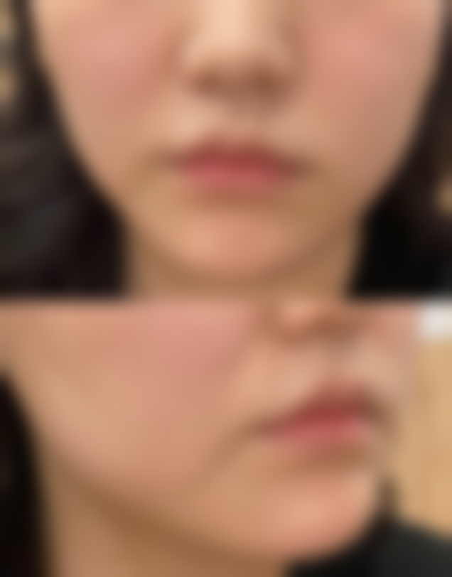 王明青医生真实实例