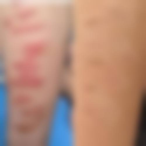 台州椒江爱美美莱整形医疗美容医院擅长项目