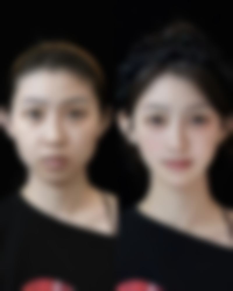 池伟誌医生擅长项目：打造专属美丽方案