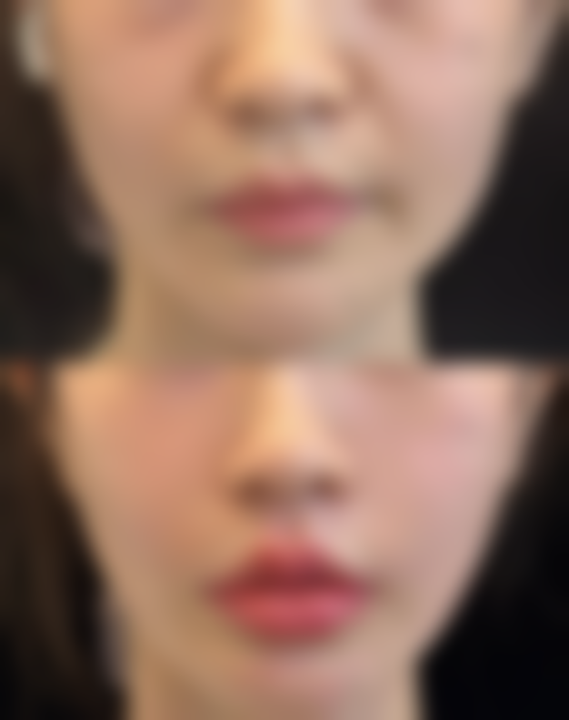 景德镇嫒幂医疗美容诊所预约挂号方式