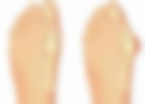 隆胸手术多少时间恢复？一般情况下，简单隆胸手术1-2周初步恢复，完全恢复需3-6个月！ 