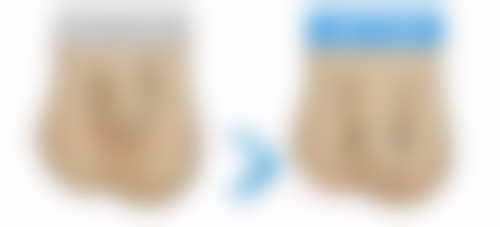 袁相斌医生技术特点