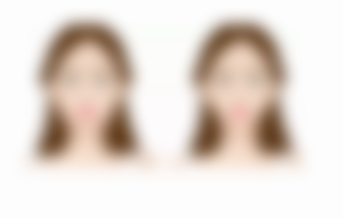 医美张升医生怎么预约挂号