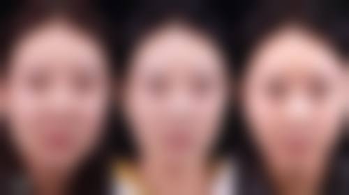 中医张升医生真实实例