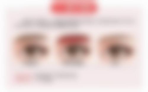 隆胸手术修复期间要注意什么