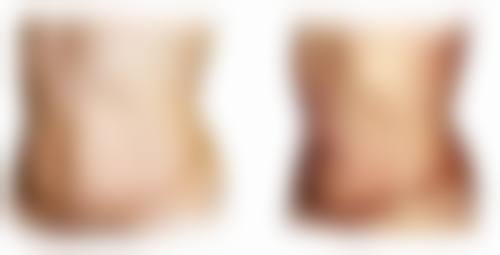 医美张升医生看诊优势