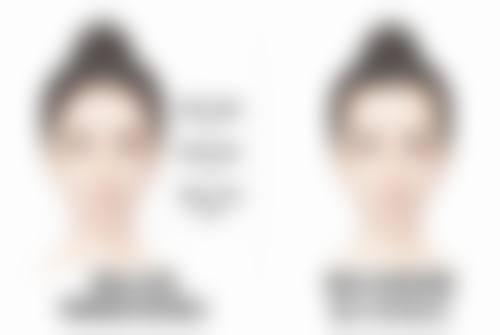 双眼皮白色疤痕怎么去除？掌握激光祛疤、微晶磨皮及药物涂抹三大方法，轻松告别眼部瑕疵！ 