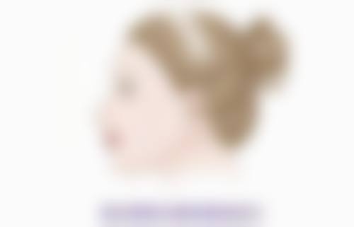 双眼皮白色疤痕去除后会复发吗