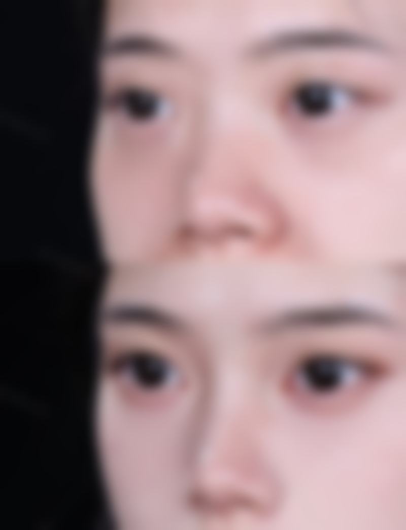 割双眼皮多久可以化妆？