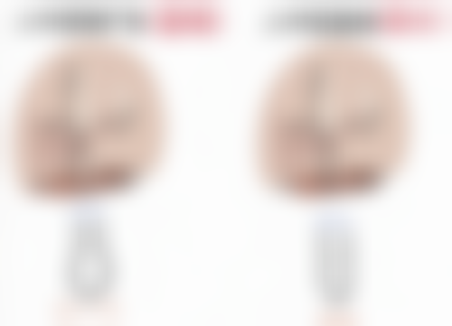 疤痕体质脂肪瘤怎样去除？权威医美方案来助力，精准操作安全无痛，快速消除脂肪瘤不是梦！ 