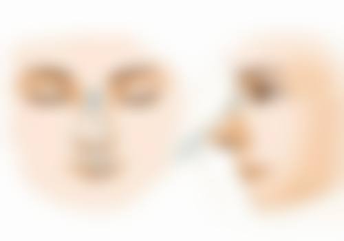 种头发原理头发种植的原理是什么？原来它是通过提取毛囊再移植，让你轻松拥有浓密秀发！ 