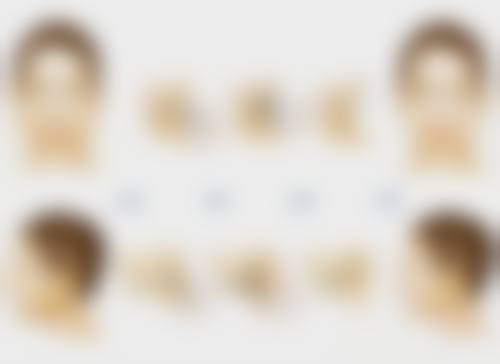 烫伤出现疤痕增生放射治疗怎么样