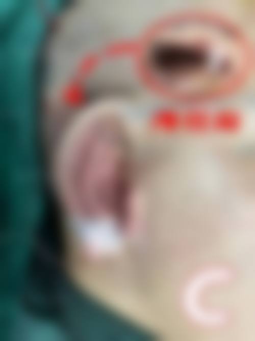 郑州星媛医疗美容真实实例：见证美丽蜕变