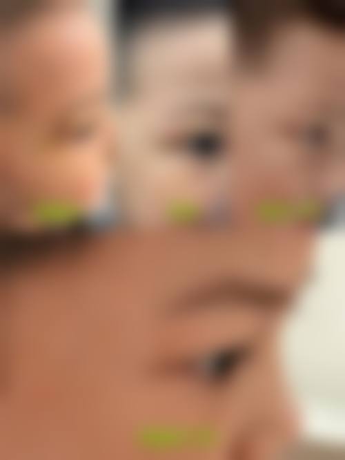 吕梁华旗亚都整形医院价格表