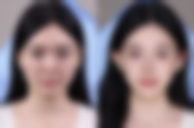 郑州星媛医疗美容仪器设备：精良科技助力美丽