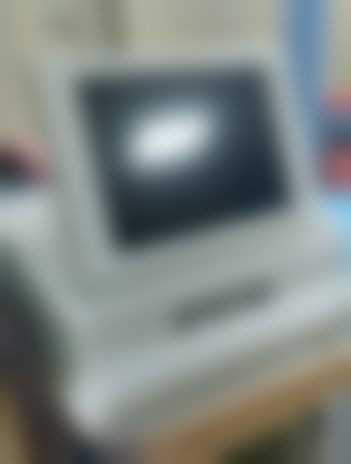 张敦苗医生真实实例