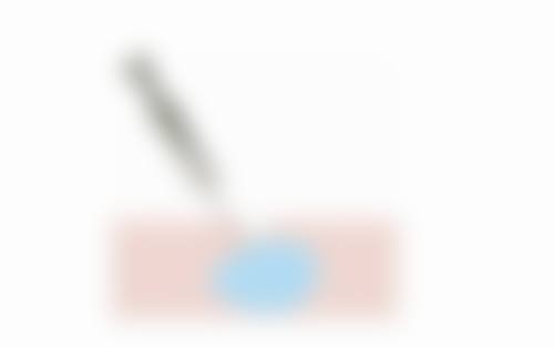 武汉大众口（岳家嘴门诊）地址及乘车路线：轻松找到目的地