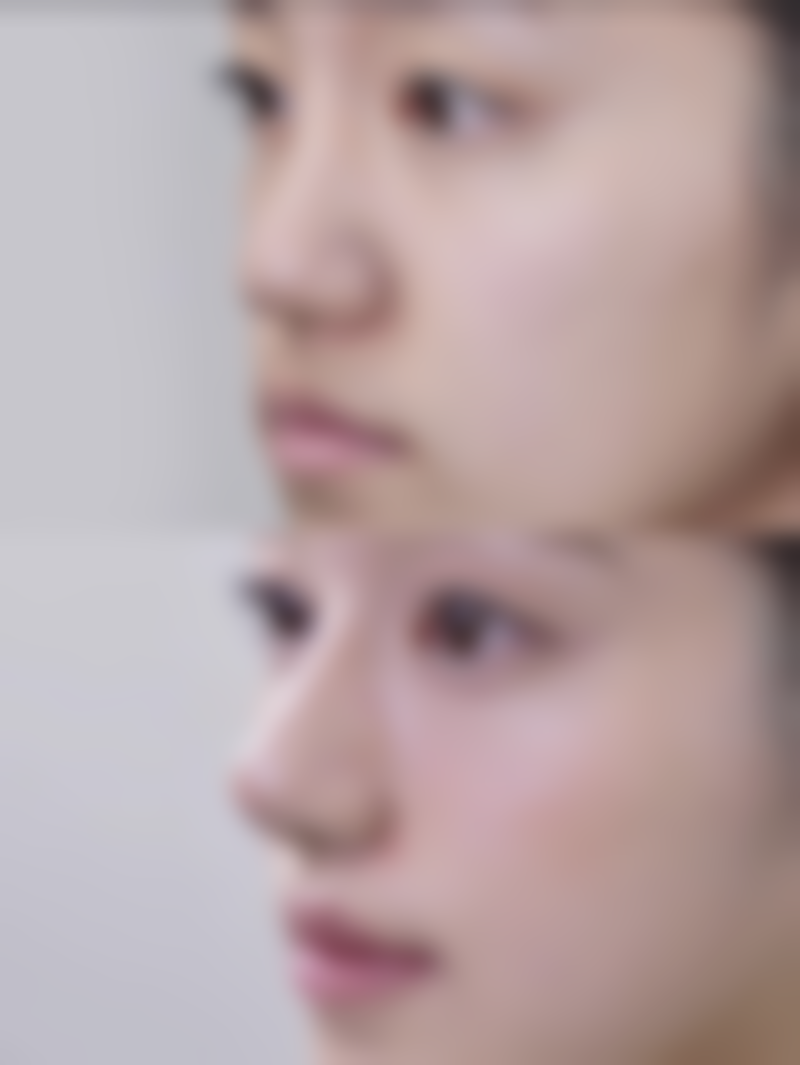 看眼袋黑眼圈挂什么科？医美专家揭秘，挂眼科、皮肤科或整形美容科，快速解决眼部困扰！ 