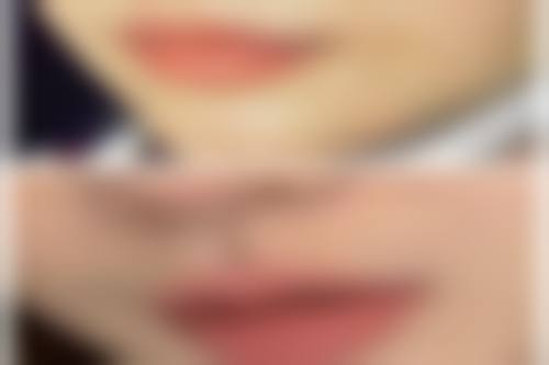 刘梅医生技术特点：精细效率高，个性化定制