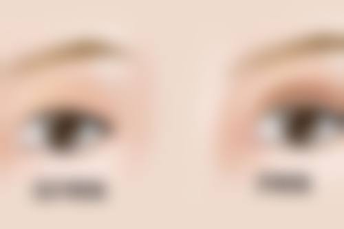 3D动画演示隆鼻手术的视频有什么优势？