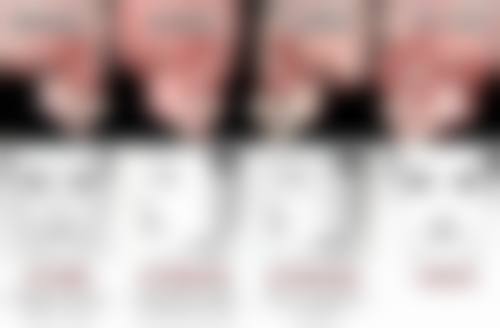 白色疤痕如何淡化？试试激光祛疤、微晶磨皮，有效改善疤痕外观，让肌肤重焕光彩！ 