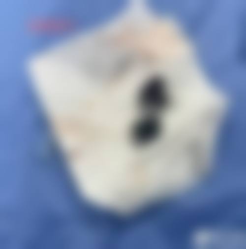 乌鲁木齐谜纱新颐美医疗美容门诊部擅长项目