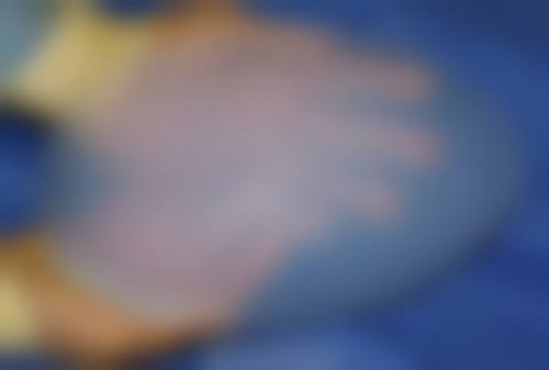 日本浅见(アサミ)美容外科医院价格表