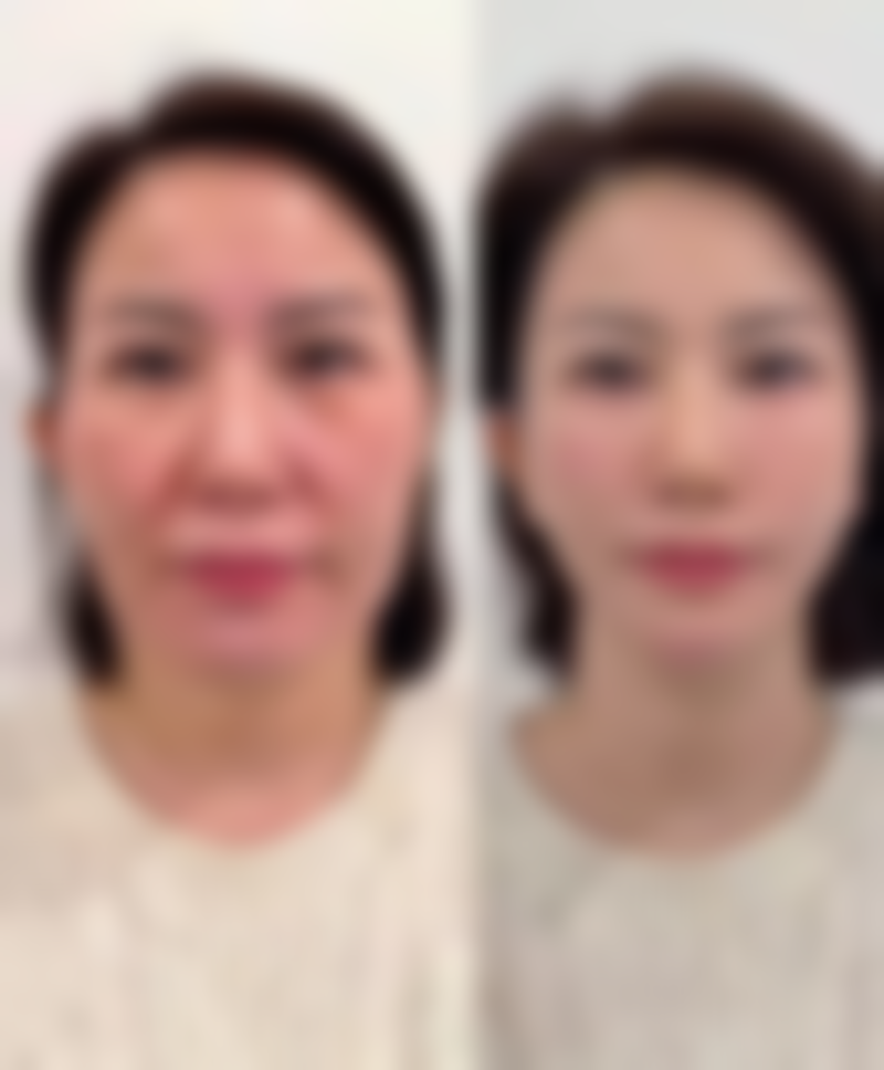 乌鲁木齐谜纱新颐美医疗美容门诊部价格表