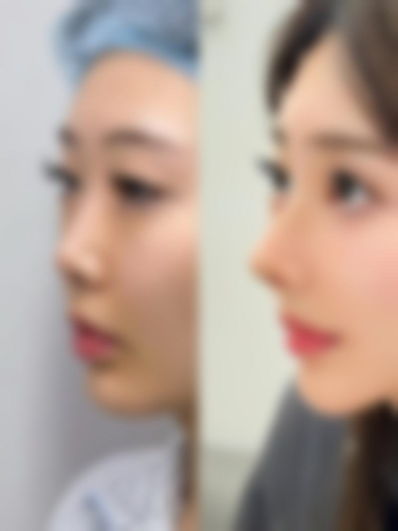 乌鲁木齐谜纱新颐美医疗美容门诊部真实实例