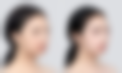 崔贤敏（Choi Hyun - min）院长擅长项目