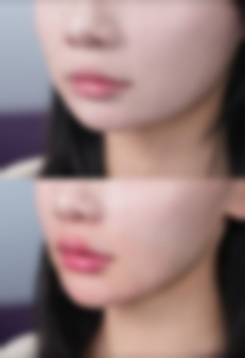 崔贤敏（Choi Hyun - min）院长真实实例