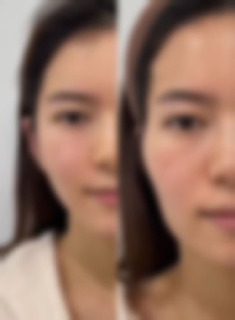 陈明希医生擅长项目：多元化的医美魔法