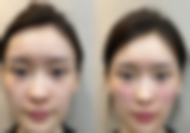 杭州东方整形美容门诊部仪器设备：精良科技助力美丽升级