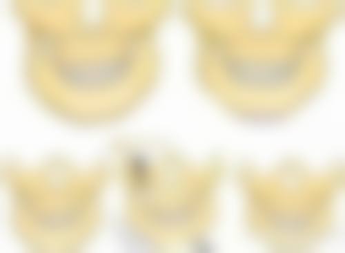 埋线双眼皮20天还不消肿正常吗？别慌，了解消肿时间规律，掌握正确护理方法助你快速恢复！ 