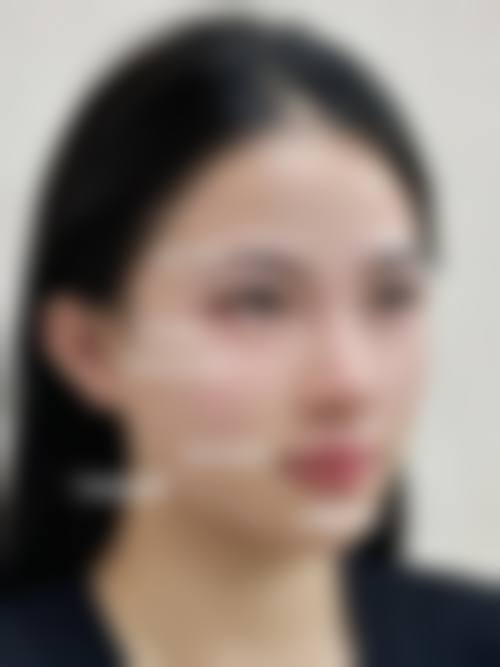 天津嘉欧医疗美容诊所价格表