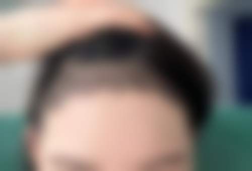 福州博美整形医院仪器设备：精良科技助力美丽