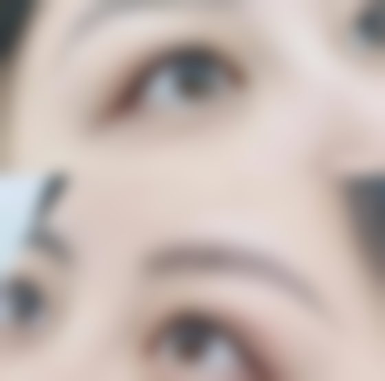 激光祛疤淡化脸部抓伤疤痕靠谱吗