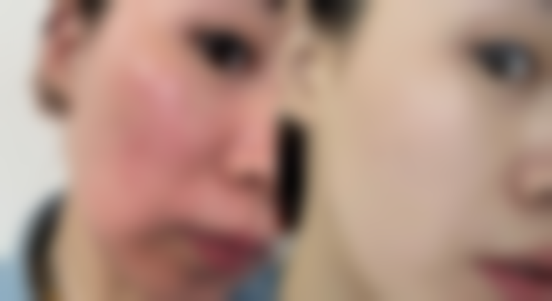 福州博美整形医院价格表：合理收费透明化