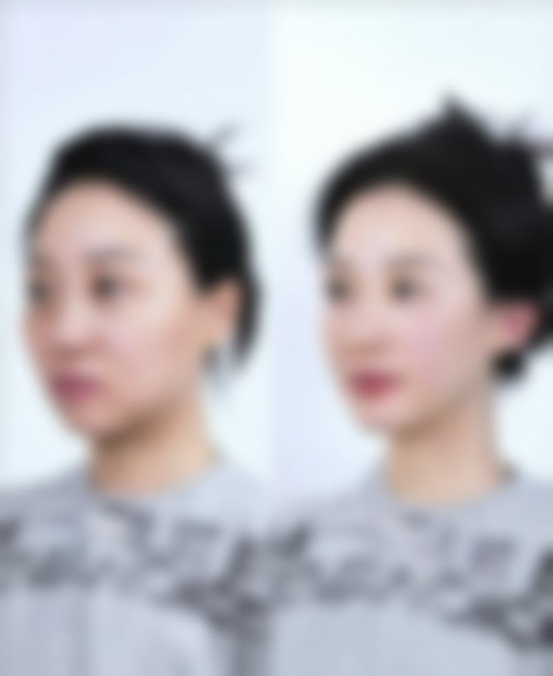 郭华峰医生技术特点