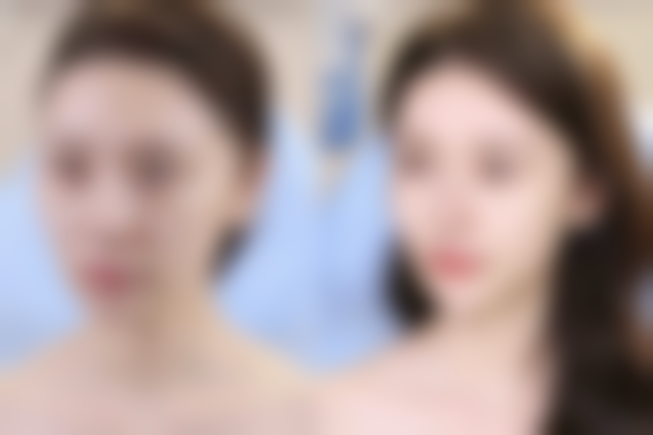 西安莲湖瑞丽医院医学美容预约挂号方式