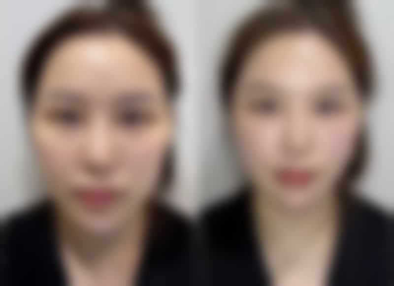 武汉芯动整形医院口碑怎么样