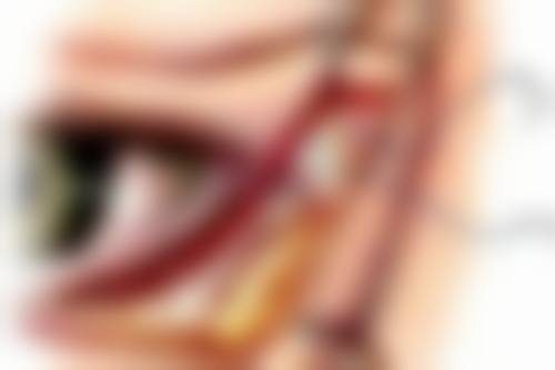 疤痕体质才会增生吗？其实非疤痕体质在特定情况下也可能增生，了解这些原因让你不再困惑！ 