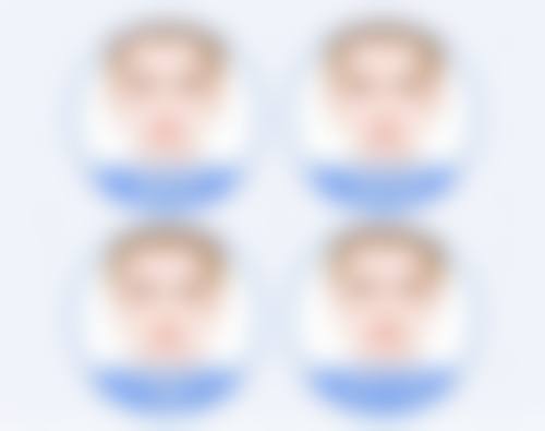 疤痕增生厉害怎么办？医美权威方案大揭秘，激光祛疤、微晶磨皮等多法助力高效修复！ 