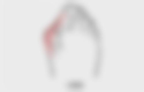 九江善善伊美整形医院真实实例